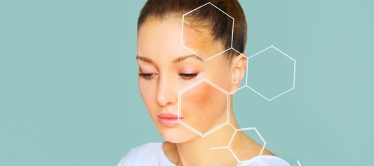 5 Skin Concerns The Magic Fives Tackles (And How)